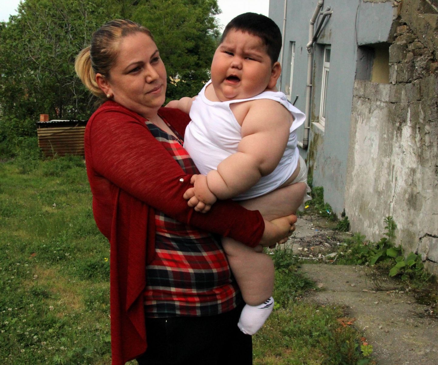 Görenler gözlerine inanamıyor! 1,5 yaşında 32 kilo...