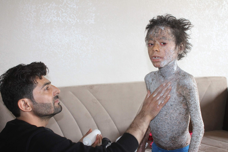 Türkiye Melih'in acısına duyarsız kalmadı!