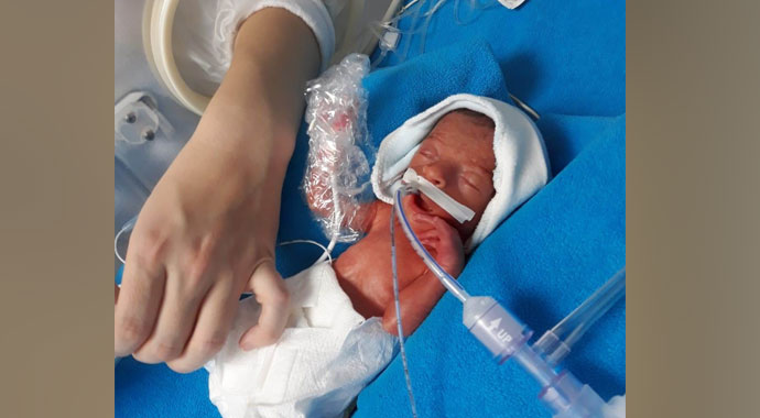 700 gramlık parmak bebek hayata tutundu