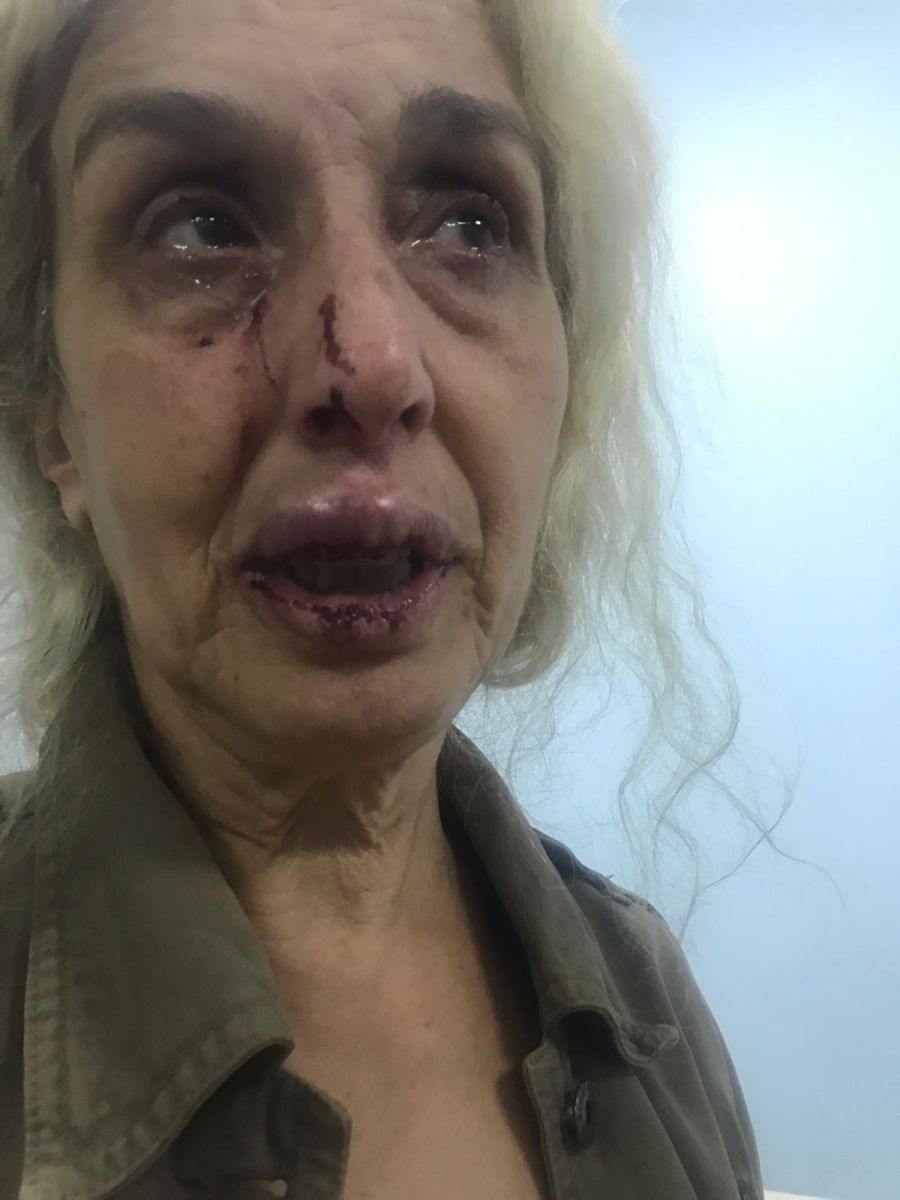 Sokak hayvanlarını beslerken başka kadınların saldırısına uğradı