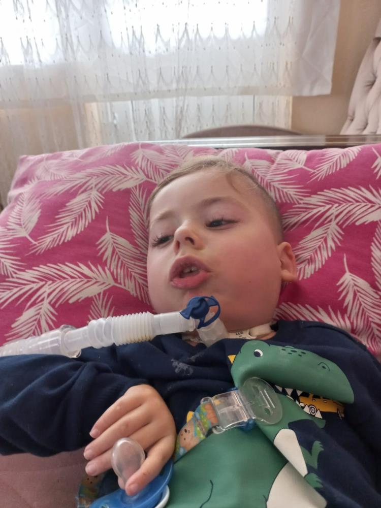 SMA hastası küçük Mustafa’nın tüm cihazları yangında kül oldu