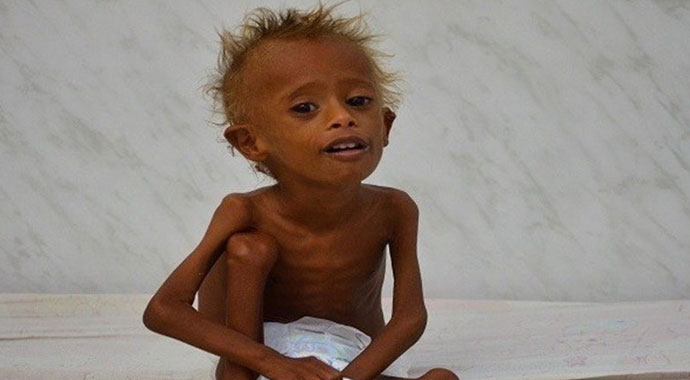 Yemen, geniş çaplı kıtlık tehlikesiyle karşı karşıya