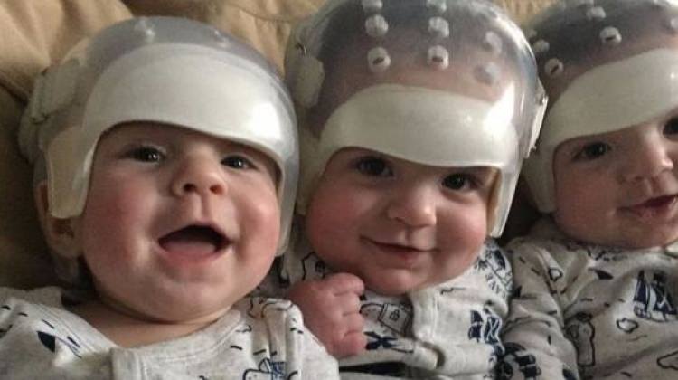 500 trilyonda bir hastalıkla doğdular