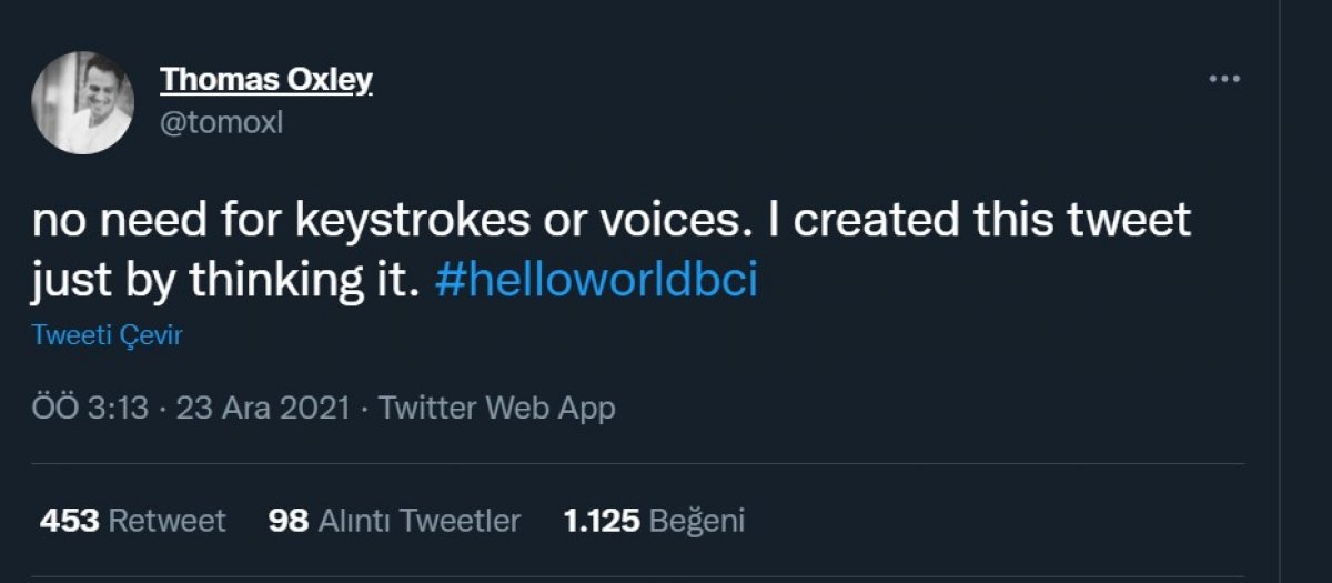 Sonunda bu da oldu! Beyin çipi yoluyla ilk tweet