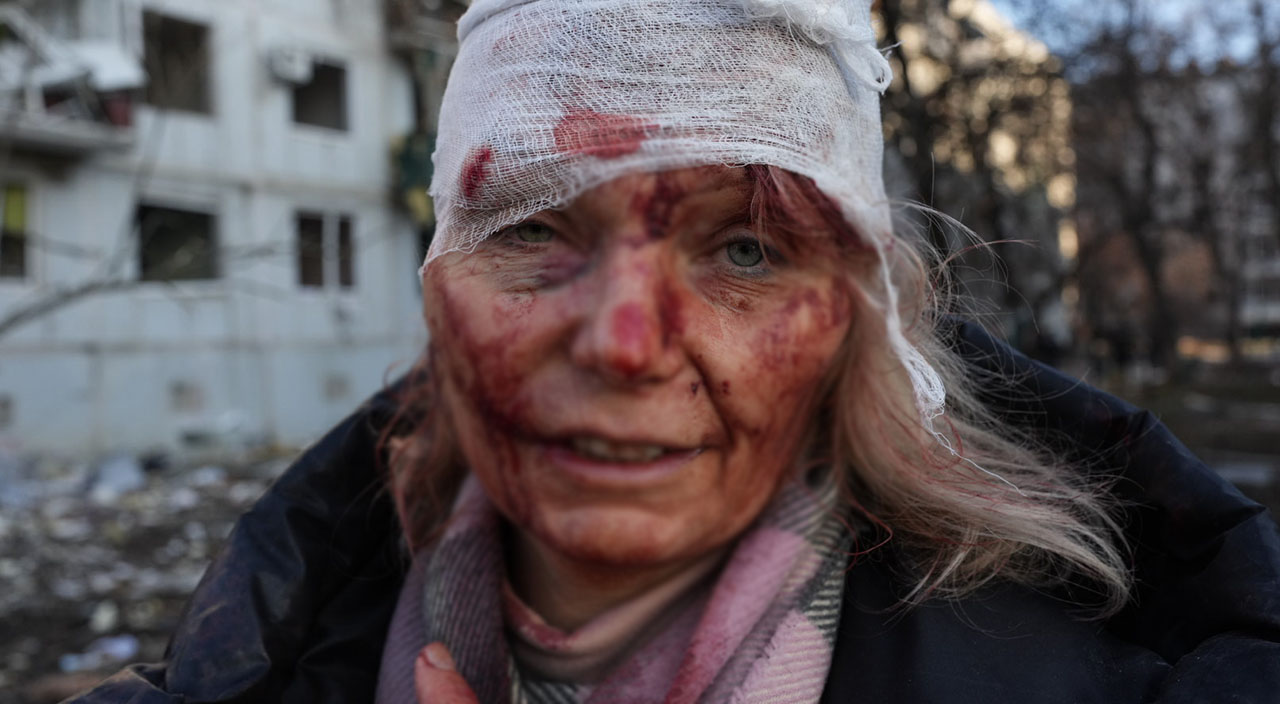 Ukrayna duyurdu: Rusya sivilleri vurdu çok sayıda ölü ve yaralı var