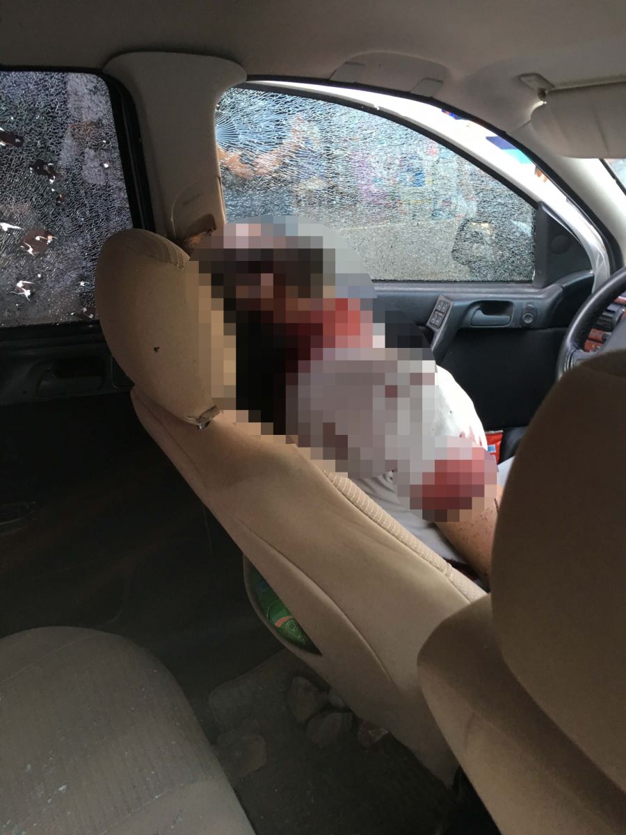 Şanlıurfa'da akraba kavgası: 2 ölü 9 yaralı