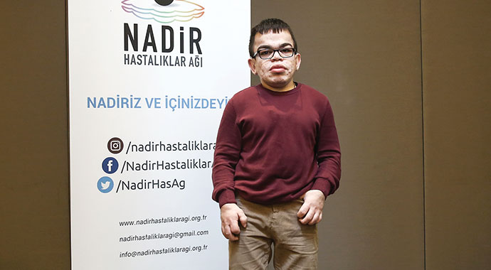 Nadir hastalıklar 6 milyon kişiyi etkiliyor
