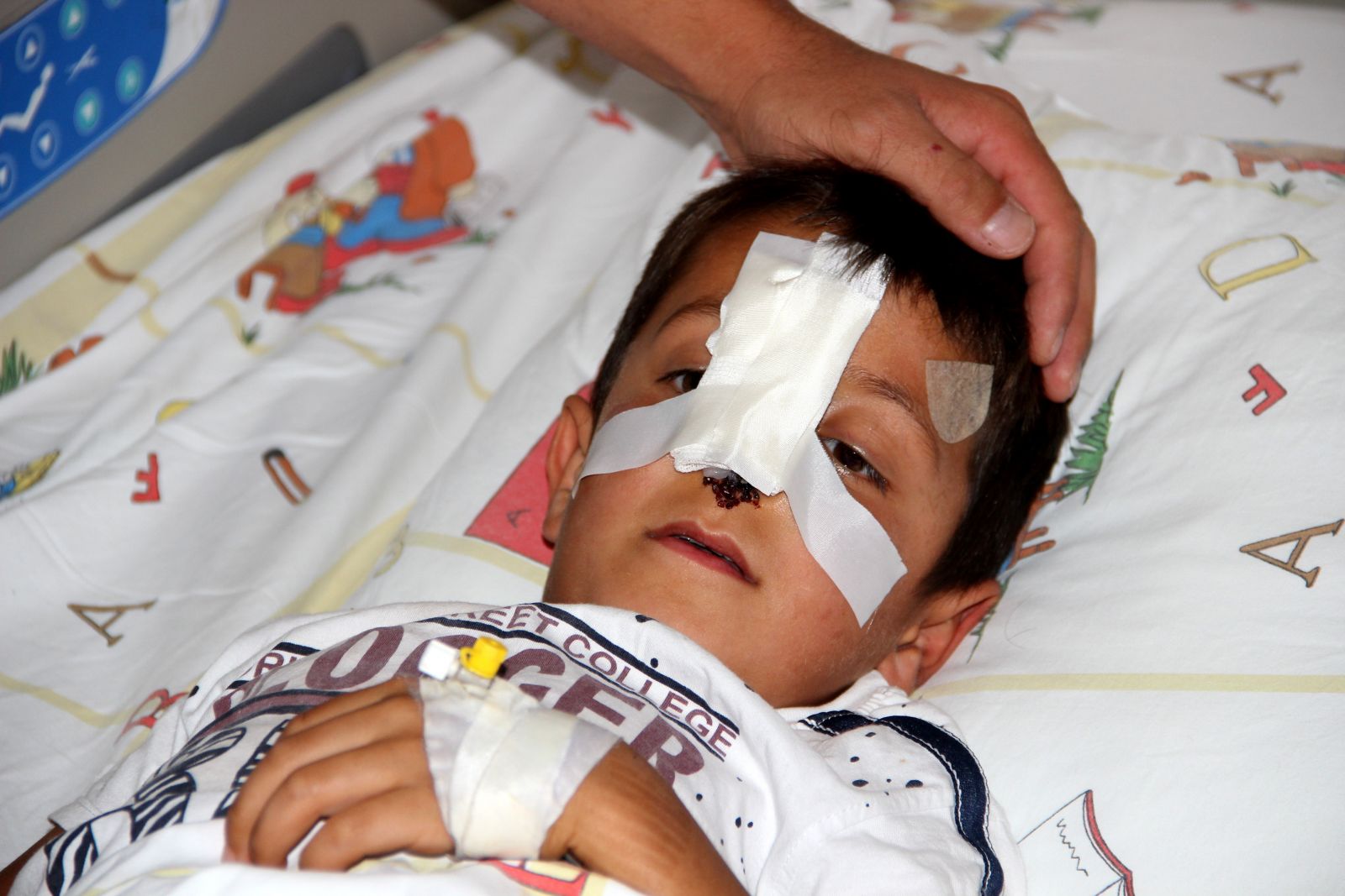 Sokak köpekleri minik Bünyamin'in burnunu kopardı