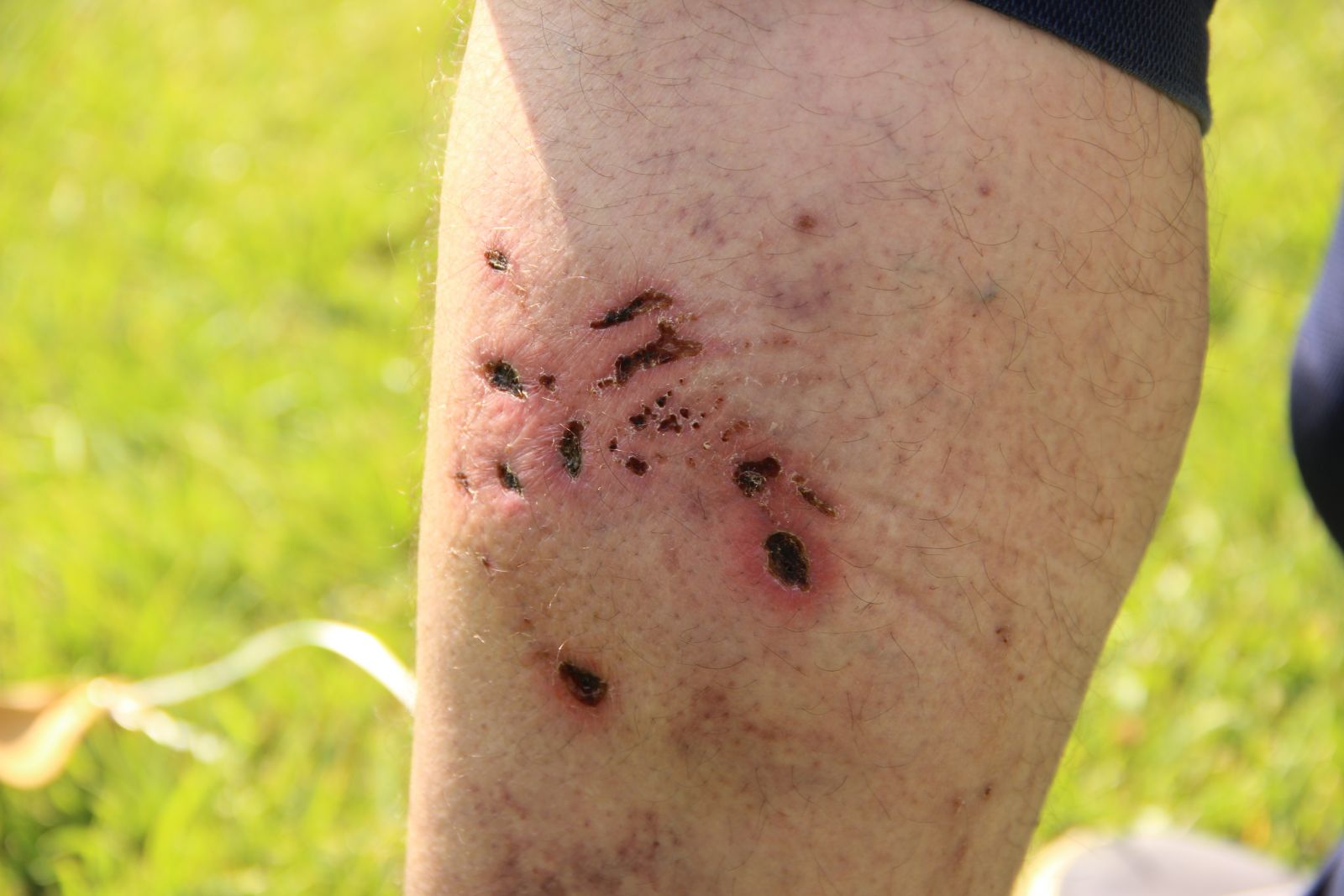 Kaldığı otelde pitbull dehşeti yaşadı