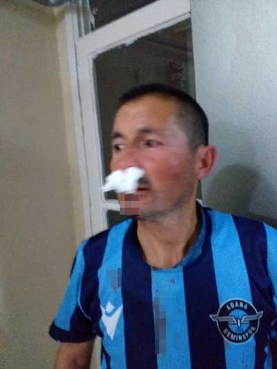 İşitme engelli adama cadde ortasında feci dayak