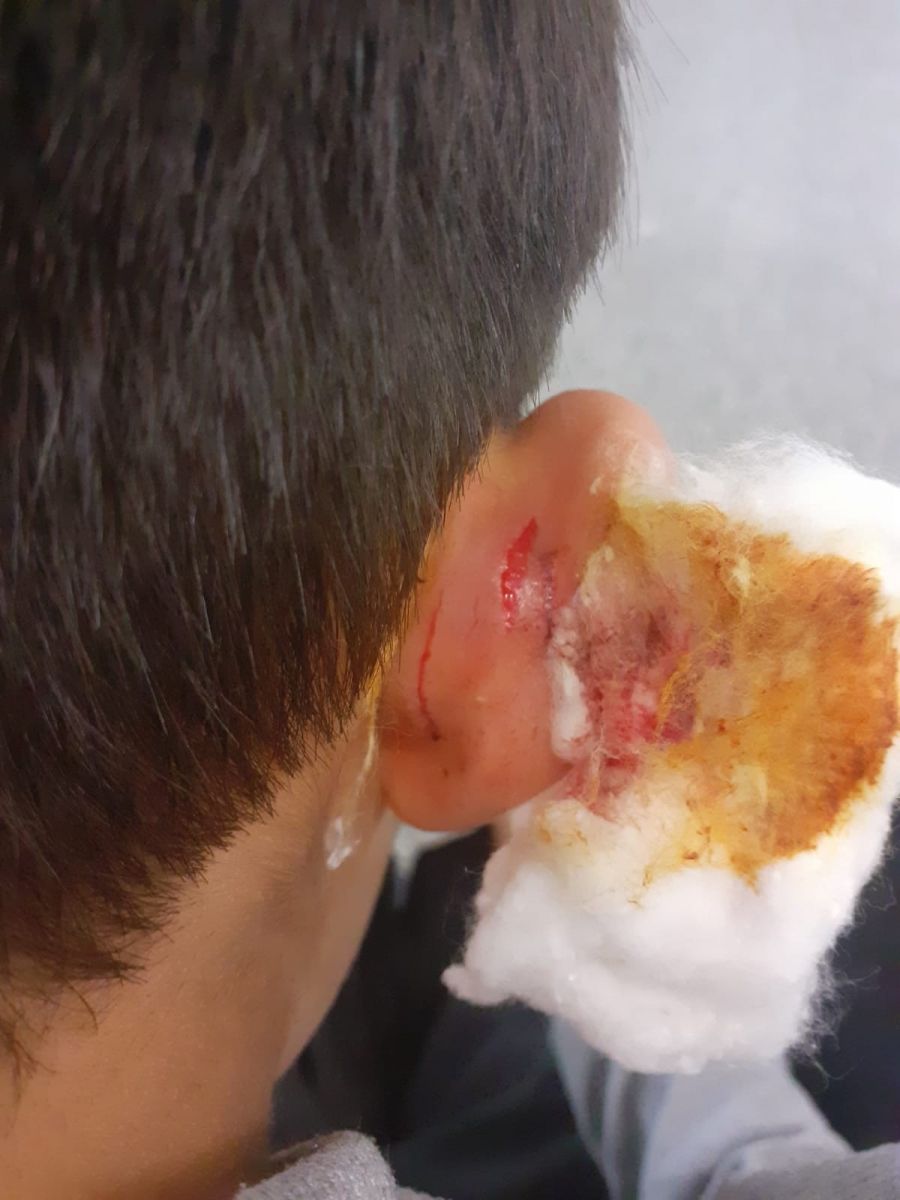 Öğrencinin kulağını çekip yaralayan öğretmene suç duyurusu