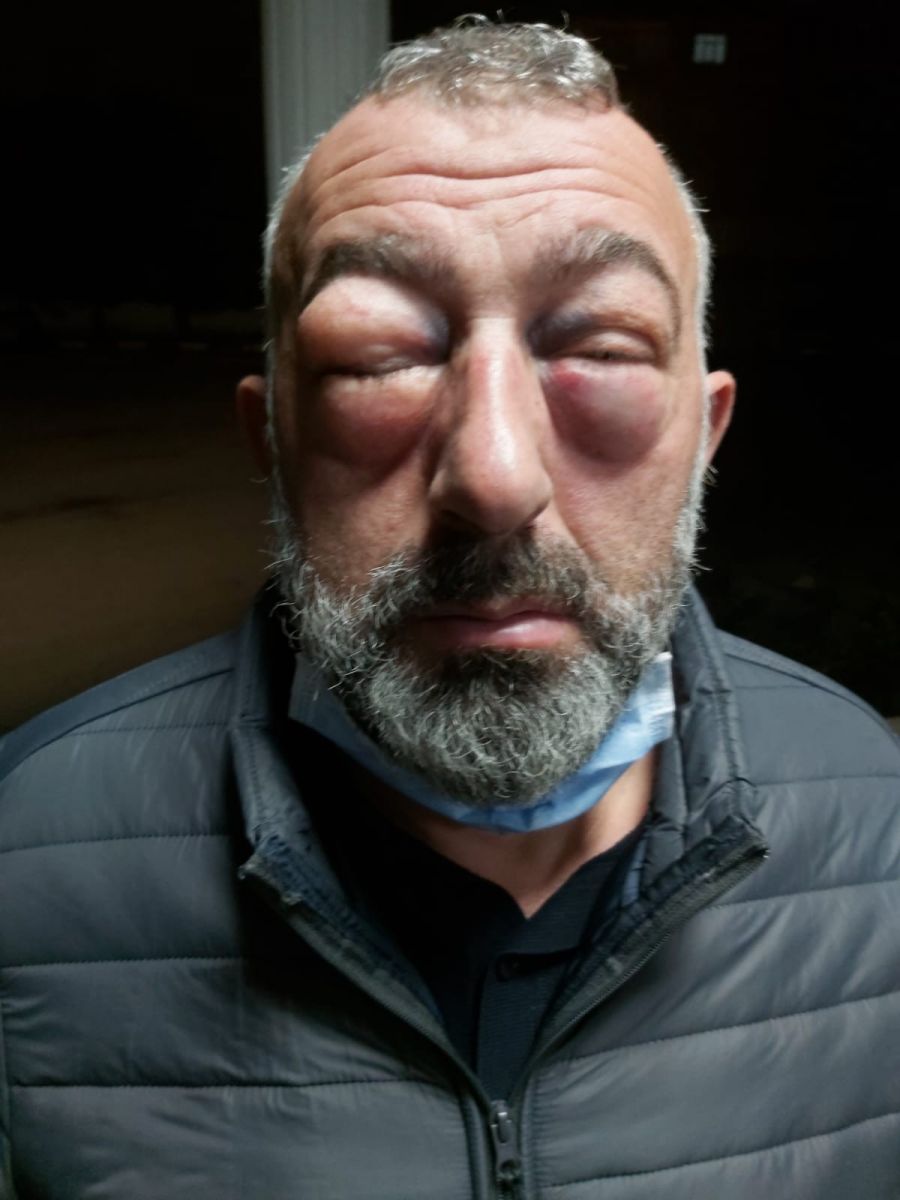 Söylenen yolcuya otobüs şoförlerinden dehşet: Feci şekilde darp edildi