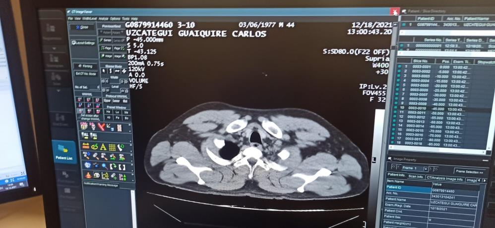 Bayılan uyuşturucu kuryesi yakayı ele verdi