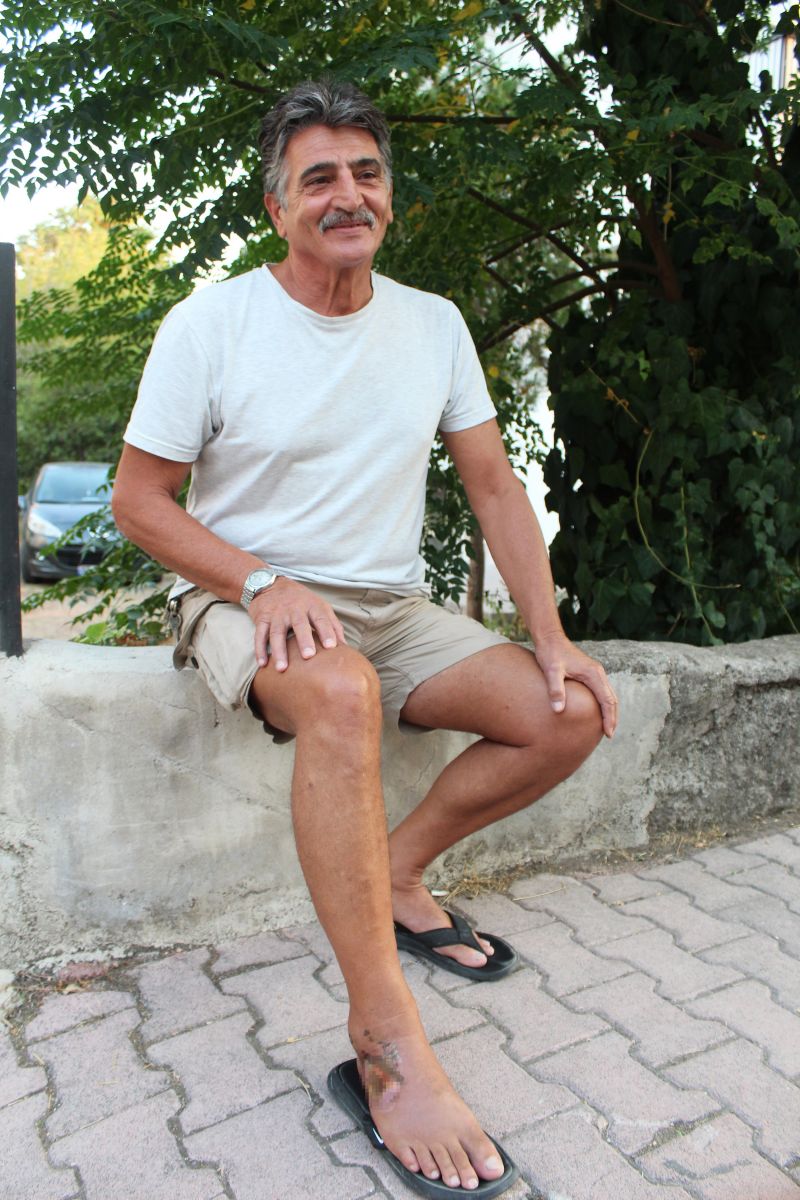 Aslan balığının zehirlediği balıkçı: 