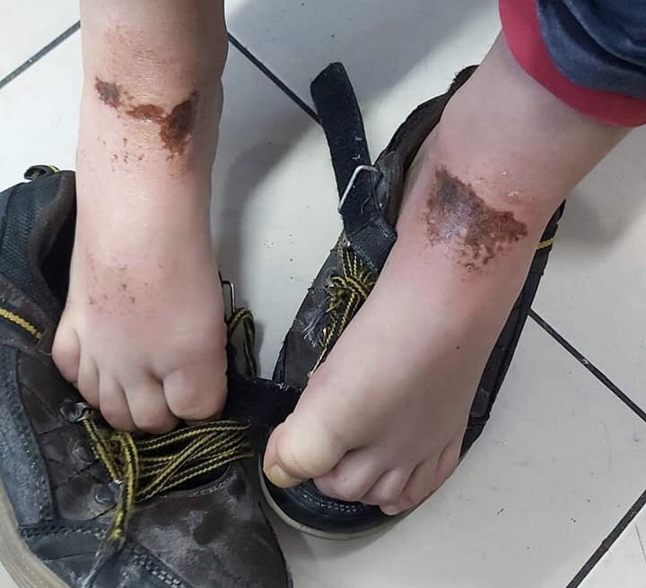 Dışarıda kar topu oynayan çocuklar bu hale geldi! AFAD'dan açıklama geldi