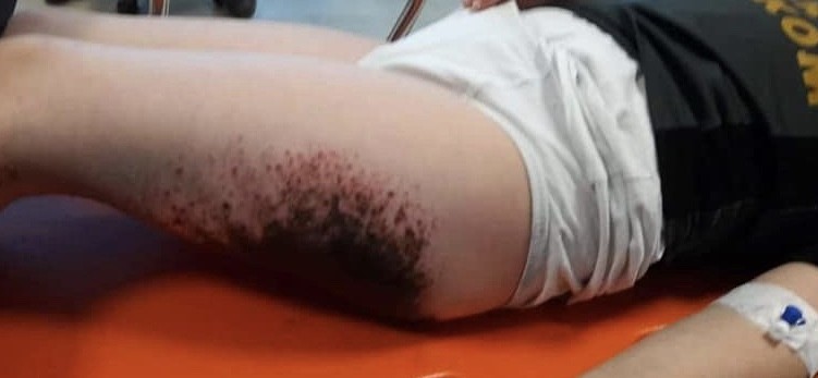 Dışarıda kar topu oynayan çocuklar bu hale geldi! AFAD'dan açıklama geldi