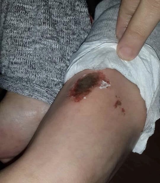 Dışarıda kar topu oynayan çocuklar bu hale geldi! AFAD'dan açıklama geldi