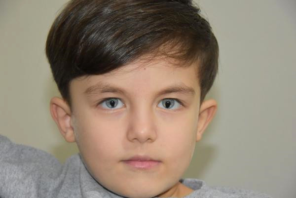 Kedi gözlü çocuk: Gece karanlığında da görüyorum