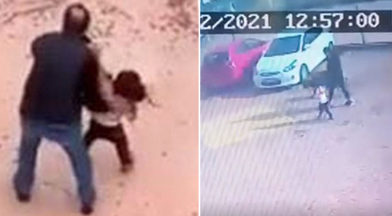 Pitbulların yaraladığı Asiye'nin son durumunu doktoru açıkladı