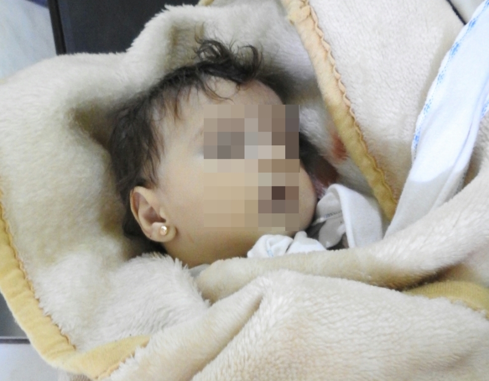 Katil Esad güçlerinden kimyasal katliam: En az 100 ölü var