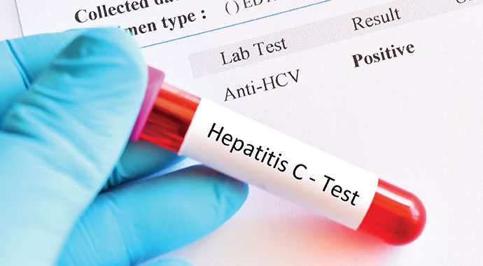 Kayıp hasta aranıyor