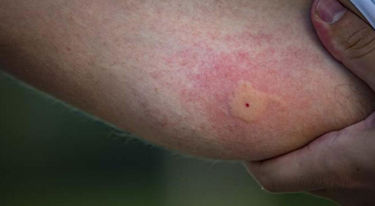 Komşuda 11 cana mâl oldu... Sinsi virüs Türkiye sınırına dayandı!