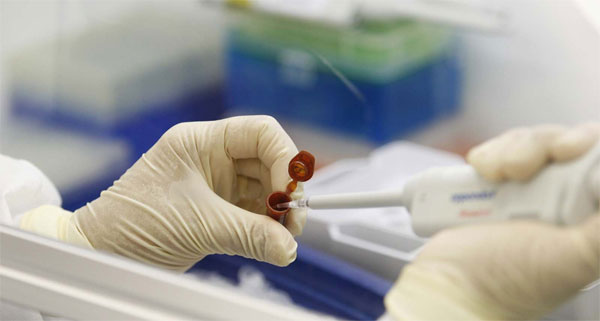 Domuz Gribinin Belirtileri Nelerdir? Domuz Gribi Nedir, Öldürür mü, Domuz gribinin tedavisi var mıdır?