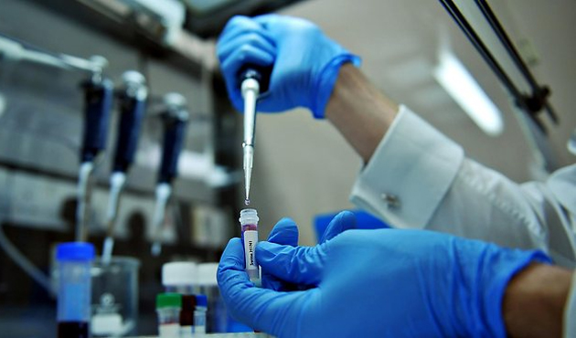 Domuz Gribinin Belirtileri Nelerdir? Domuz Gribi Nedir, Öldürür mü, Domuz gribinin tedavisi var mıdır?