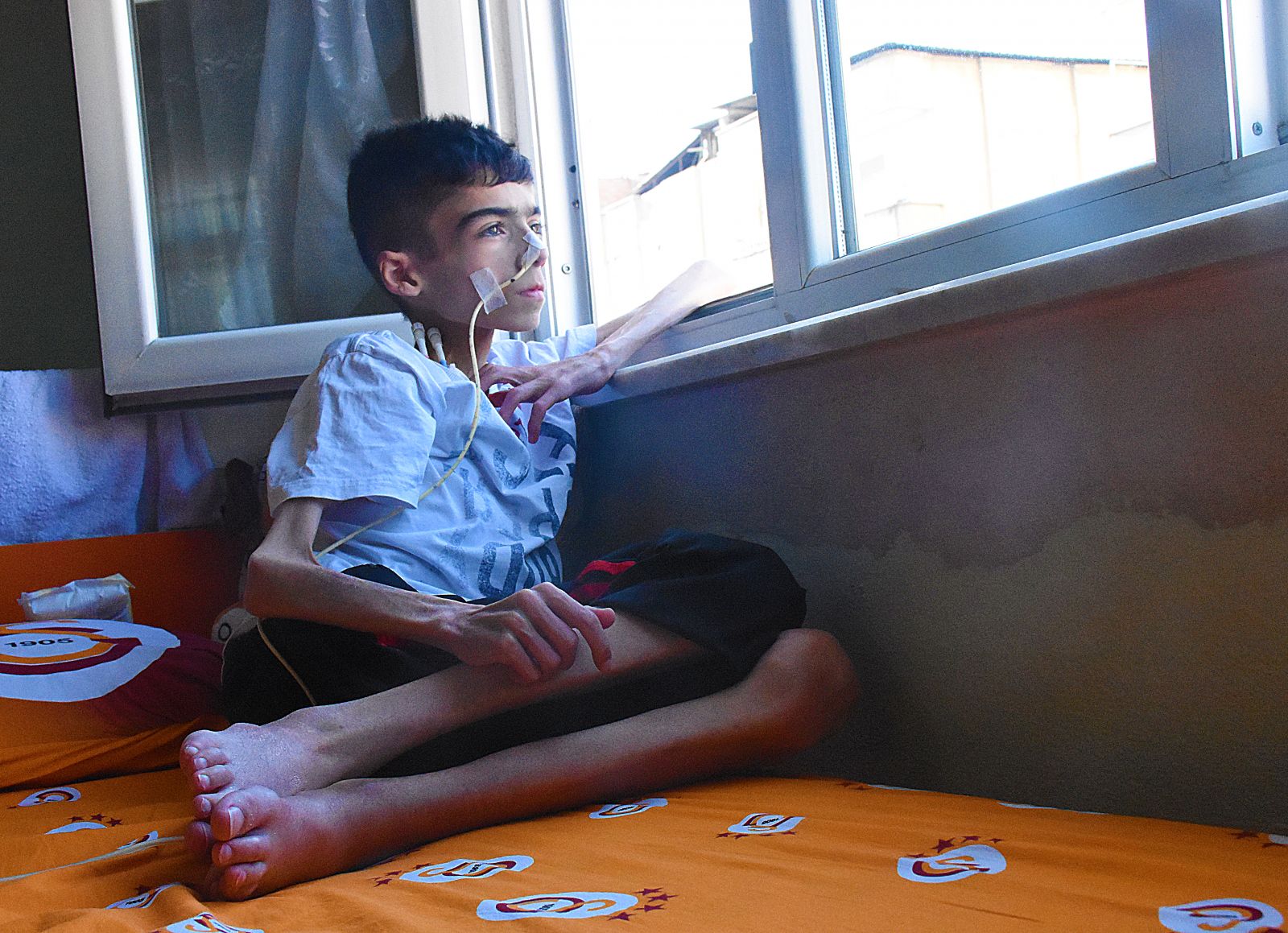 Çocukluğunu yaşayamadan günden güne eriyor