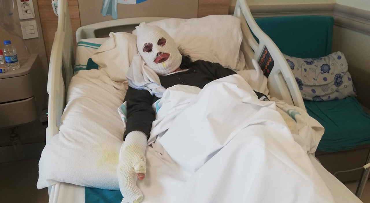 Gaz kokusunu çakmakla kontrol eden yaşlı kadın feci şekilde yandı