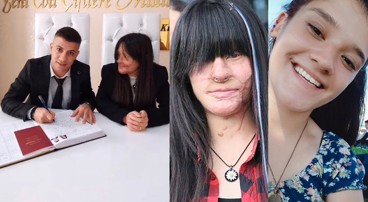 Berfin, yüzüne asit atan erkek arkadaşıyla evlendi!