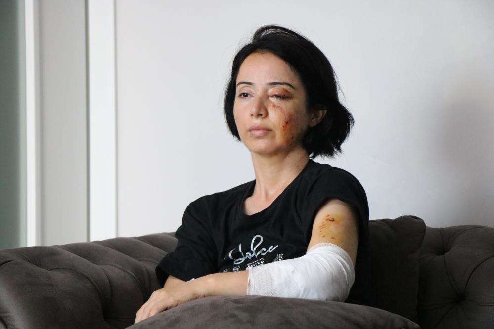 Samsun'da dehşet! Köpeklerin saldırısına uğrayan anne kız hastanelik oldu