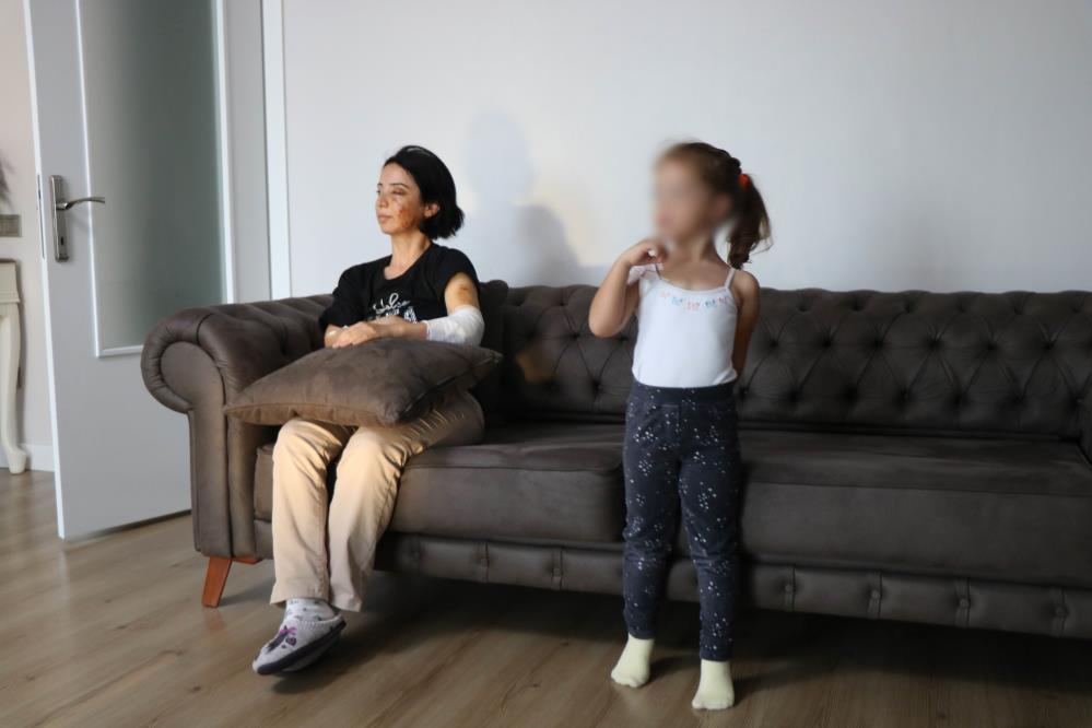 Samsun'da dehşet! Köpeklerin saldırısına uğrayan anne kız hastanelik oldu