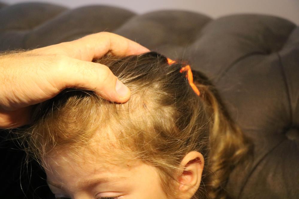 Samsun'da dehşet! Köpeklerin saldırısına uğrayan anne kız hastanelik oldu