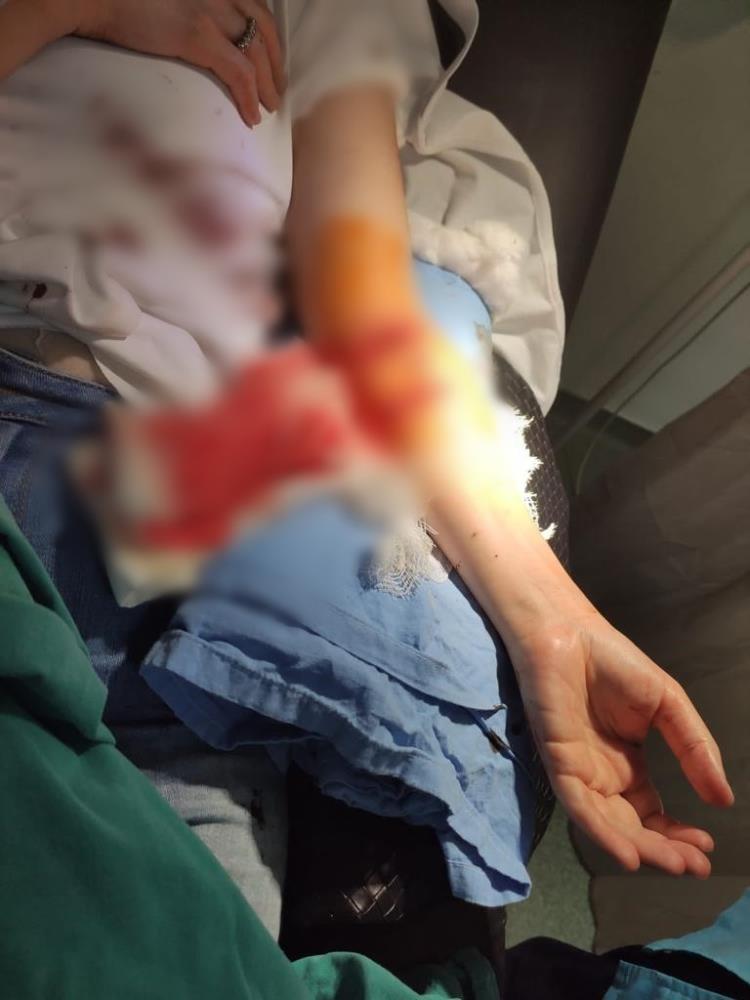 Samsun'da dehşet! Köpeklerin saldırısına uğrayan anne kız hastanelik oldu