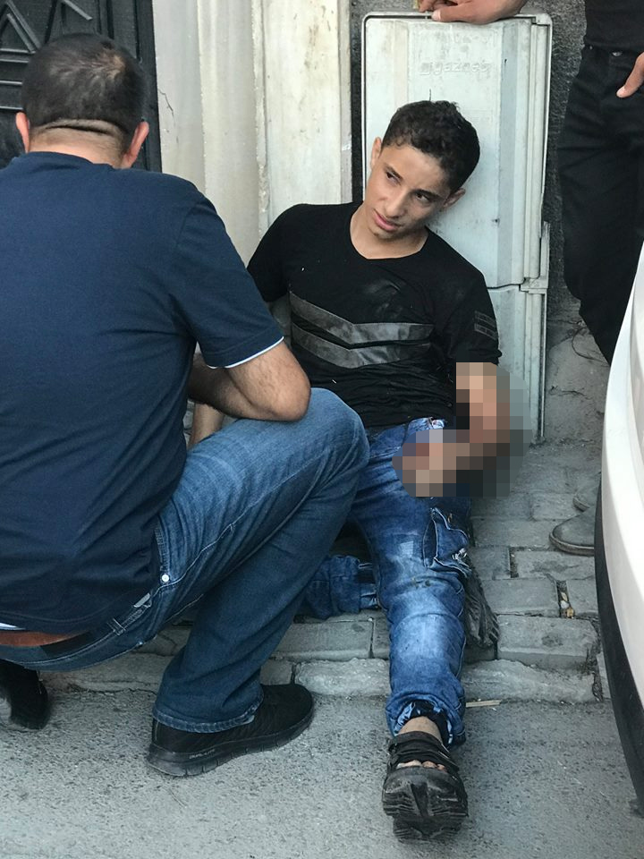 Bıçaklanan iki kardeş metrelerce yürüdükten sonra yere yığıldı