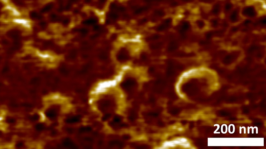 Türk bilim adamları yerli süper mikroskopla Covid-19'u görüntülemeyi başardı Türk bilim adamları yerli süper mikroskopla Covid-19'u görüntülemeyi başardı