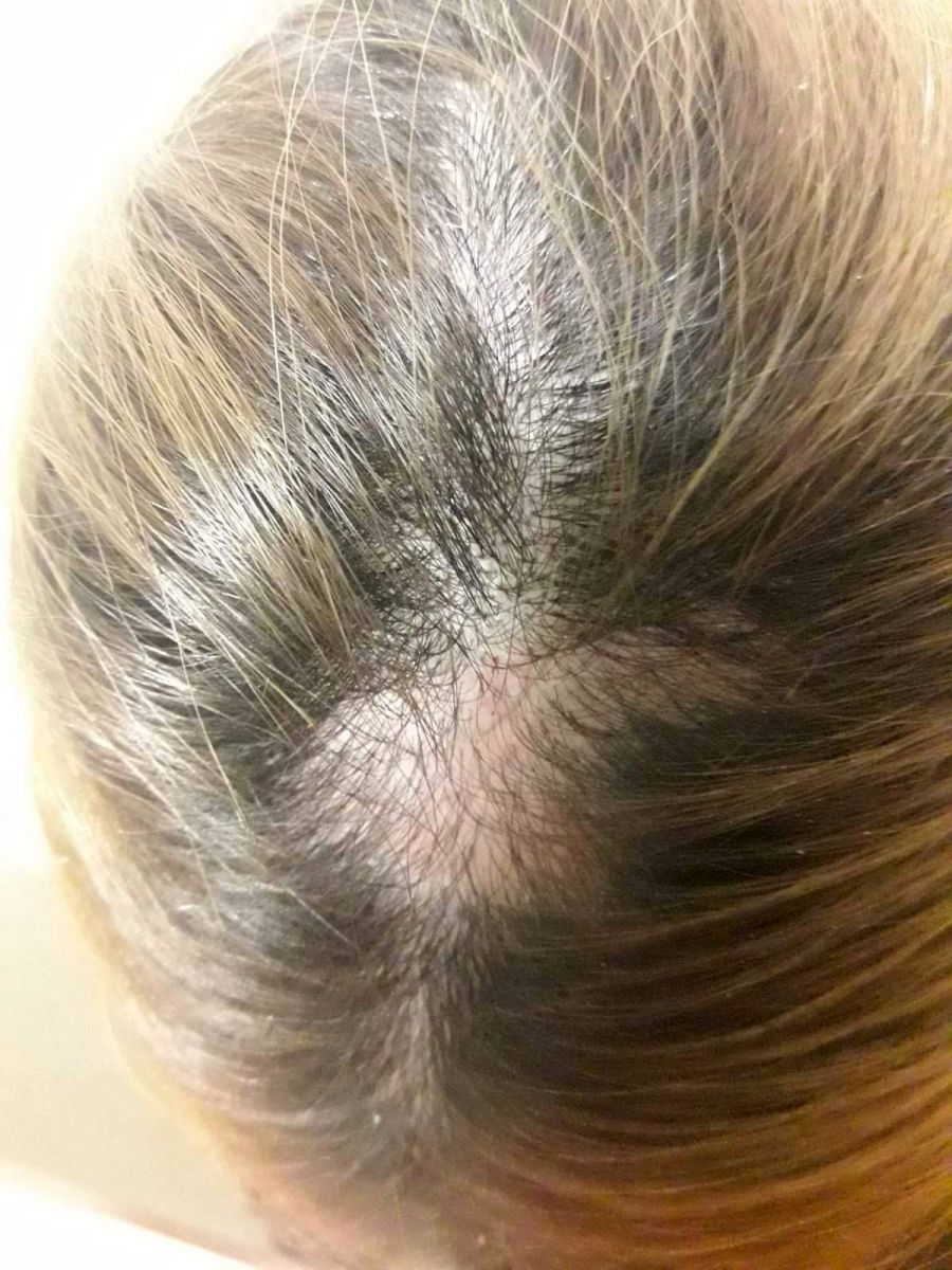 Hasta yakını genç kızın sağlık çalışanını darp edip saçını kopardığı iddiası