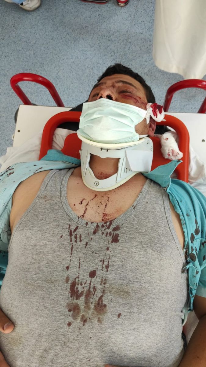 Saldırıya uğrayan muhabir dehşeti anlattı