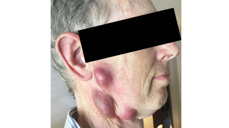 Kedisinden ölümcül bakteri kaptı Kedisinden ölümcül bakteri kaptı