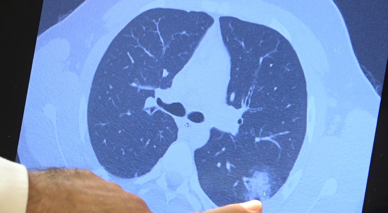 Prof. Dr. Özkaya: 'Çocuklarımız mutlaka aşı olmalı'