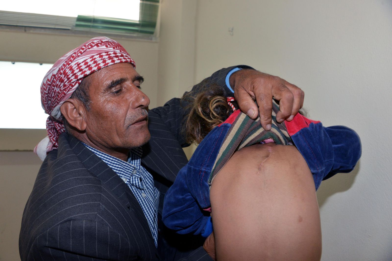 3 kollu doğan Hülya'nın sırtındaki kolu alındı!