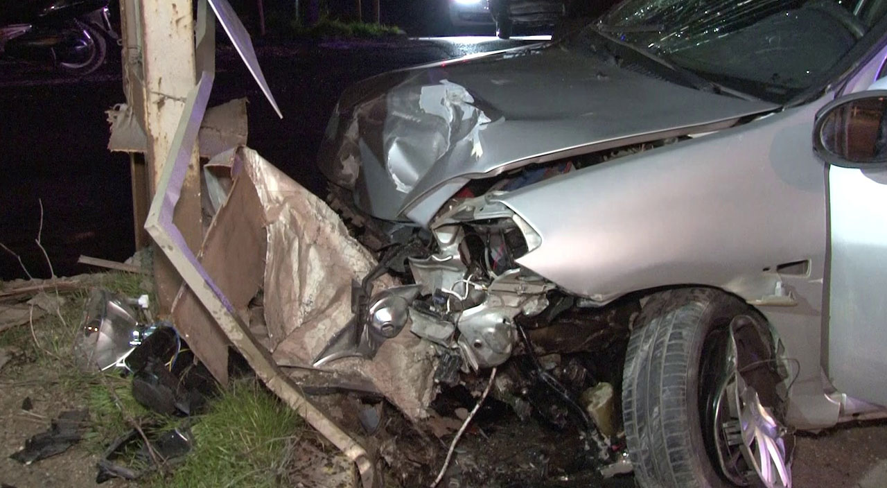 Kazada yaralanan yolcudan ilginç tepki: Çek kanka güzel çek