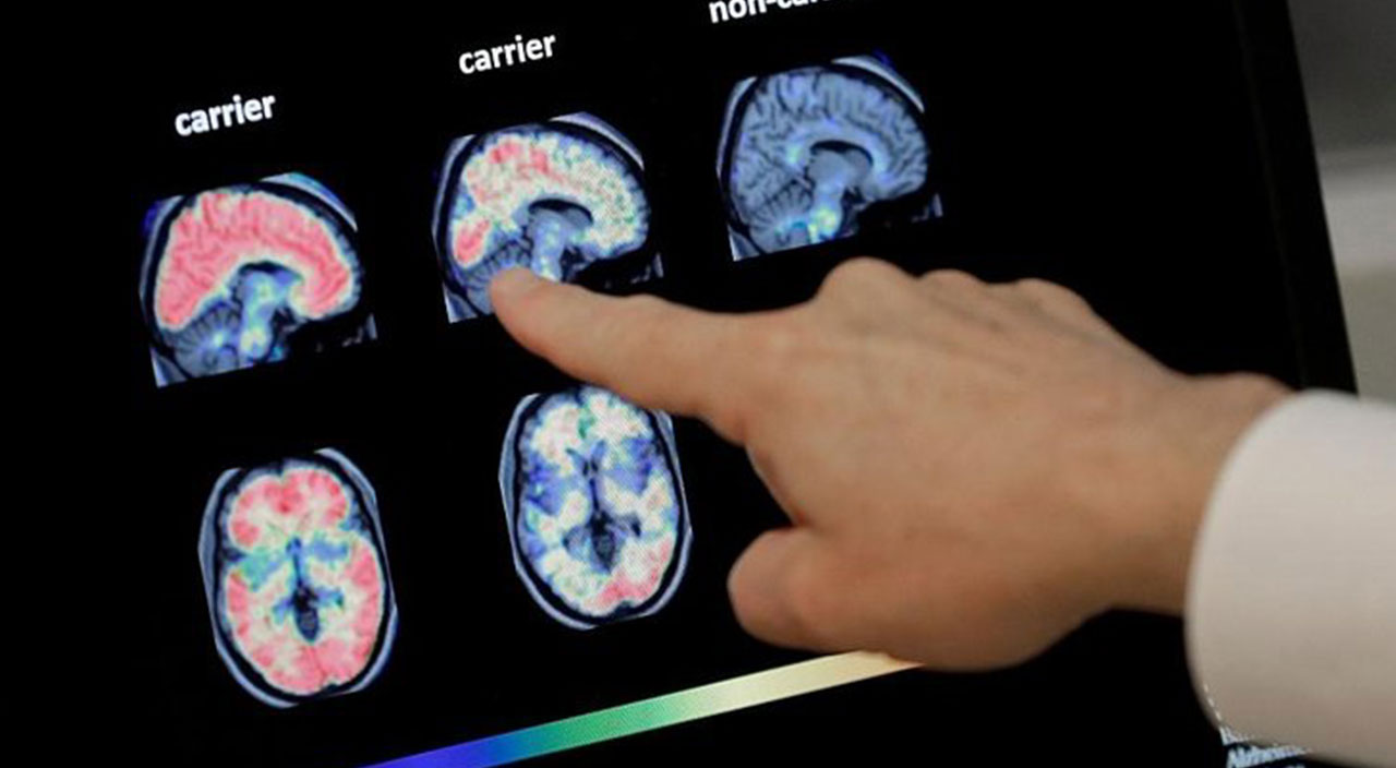 Parkta korkunç olay! Çocuğun burnundan giren amip beynini yedi