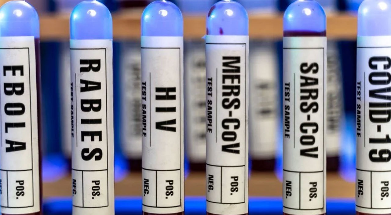 Bilim adamlarından korkutan uyarı: Bir sonraki salgını fareler yayacak