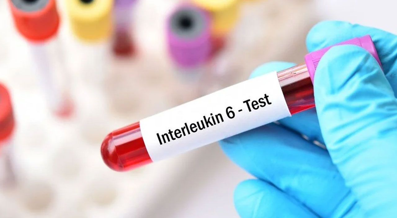 Koronavirüs tedavisinde antidepresan etkisi: Ölüm riskini 3’te bir azalttı