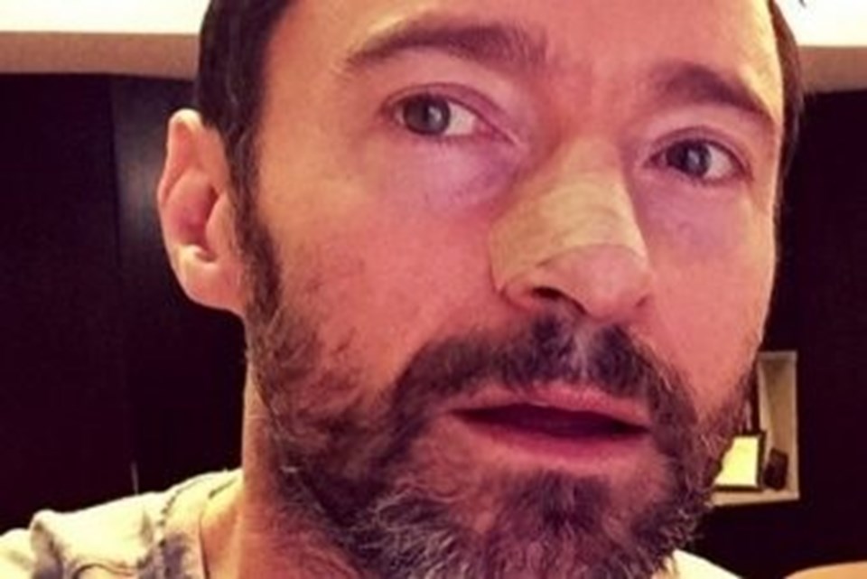 Hugh Jackman'dan kötü haber!