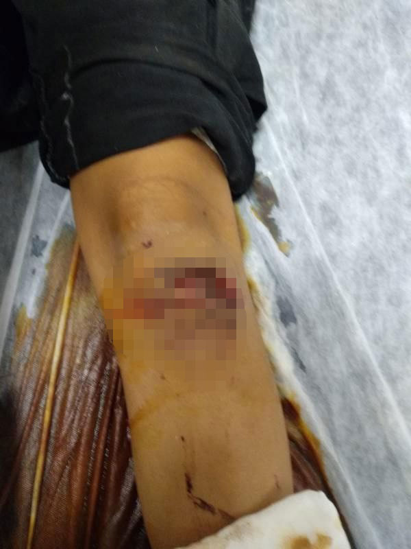 Dehşet anları kamerada: Köpek, çocuklara böyle saldırdı