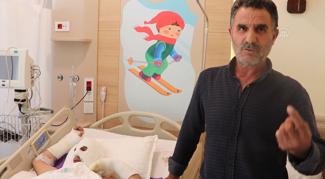 Lavabo açıcı yerine kimyasal ürün döktü, tüm vücudu yandı