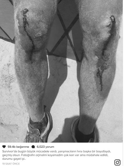 Acun Ilıcalı'dan herkesi ürküten görüntü